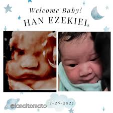 Wonder Baby 3D/4D Ultrasound