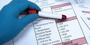 In the pcr test it is possible to differentiate between the hsv1 and hsv2 virus. Everything To Know About Fasting Lab Tests Bon Secours Blog