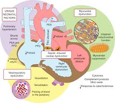 Image result for Neonatal Sepsis