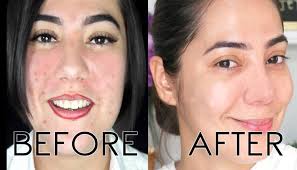 It happened 3 times before i was able to narrow down that it was specifically this product. Eseller The Ordinary Niacinamide 10 Zinc 1 30ml Face Facebook
