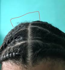 Mini braids protective style on natural hair using one product. Frizzy Crown Hair Ruins Styles Did These Flat Twist Last Night On Wet Hair And Dried With A Scarf On Mini Twists Cornrows And Mini Braids Always Get Frizzy After 3 5 Days No