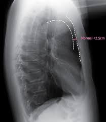 Radiology Signs Radiology Imaging Radiography Radiology