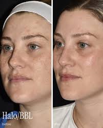 Hass Plastic Surgery & MedSpa