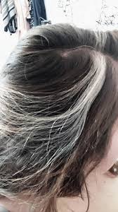 A deficiency in these vitamins has been linked to premature gray hair: This Small Patch Of White Hairs On My Head Mildlyinteresting