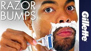 Dont touch your face too much. Razor Bumps And Ingrown Hair Gillette
