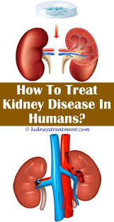 Pin On Blood Pressure Remedies