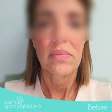 🌟 Transformación...