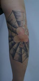 The cost can vary from location to location due to how expensive the real estate can be. Laser Tattoo Removal Seattle Seattle S Premier Tattoo Removal