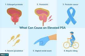 Although it is the most commonly diagnosed cancer in american women, breast cancer can impact people of all genders. Understanding Your Psa Results