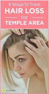 8 Simple Ways To Treat Hair Loss At The Temples Temple Hair Loss Treat Hair Loss Oil For Hair Loss
