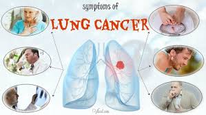 One of the first signs of cancer, including lung cancer, is unexplained weight loss. 10 Early Symptoms Of Lung Cancer In Men And Women