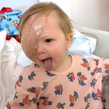 When Sandy Flash first saw Sonny's bright smile, she knew her decision to  become a living organ donor was worth it. Sonny's mom, Katie White, was  overwhelmed to meet the stranger who