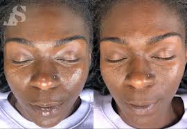 Exploring Life & Business with Meeg-wun DesJarlait of Skin Therapy