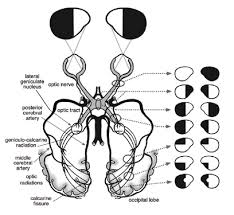 Image result for Visual Field Deficit