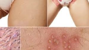 If you want to know how to eliminate them permanently from private parts, you can also use the ipl technology machine. How To Shave Private Parts Female Kobo Guide