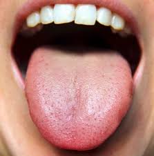 The Basics Of Tongue Analysis