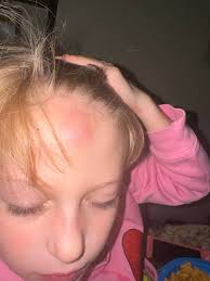 Autism Parents Support Group