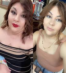 Weight Loss Surgery Before and After Gallery Amarillo TX