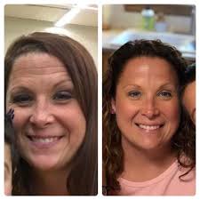 What can be used for dry skin, fine lines and wrinkles