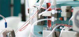 Patienten, die ihre dialyse zu hause erhalten, leben möglicherweise länger und weisen eine bessere lebensqualität auf als patienten mit herkömmlicher hämodialyse. Mobile Dialyse Via Ersatzniere In Der Weste