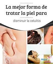 Remedios Naturales Para La Celulitis Mejor Con Salud Celulitis Eliminar Piel De Naranja Piel De Naranja
