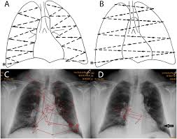 Image result for XRay Interpretation