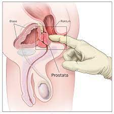 Orgasmus prostata