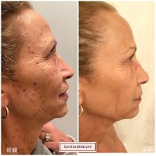 Aesthetician & Skincare Expert (@katrinaskincare) • Instagram photos and  videos