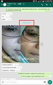 Kesimpulannya, tiada produk kosmetik, skincare, krim muka, ubat yang lulus kkm atau ada kelulusan kkm. Tabita Skincare Kelulusan Kkm