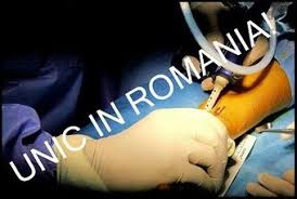 Sindrome del tunel carpiano, pruebas y test diagnosticos. Endoscopie Canal Carpian Operatie Sindrom Tunel Carpian Clinica Ortopedie Bucuresti