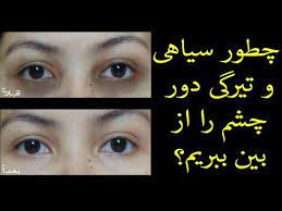 چطور سیاهی و تیرگی دور چشم را از بین ببریم youtube beauty skin care routine beauty skin care youtube
