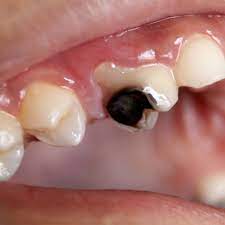 What To Do If Your Floss Or Tooth Smells Bad After Flossing Dr G Wheeler