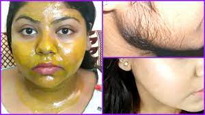 It must be done by a professional, such as a dermatologist or licensed esthetician. How To Remove Facial Hair Permanently At Home à¤š à¤¹à¤° à¤• à¤…à¤¨à¤š à¤¹ à¤¬ à¤² à¤• à¤¹à¤Ÿ à¤¯ Youtube