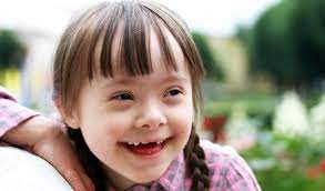 Im national down syndrome cytogenetic register in großbritannien waren im jahr 2003 insgesamt 244 zwillingspaare registriert; Down Syndrom Deximed