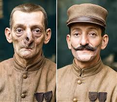Sculptor creates masks for wounded soldiers