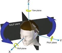Image result for Horizontal Head Impulse Test