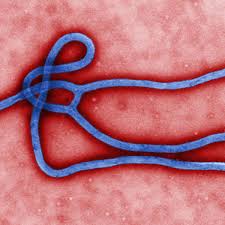 „möge gott alle ärzte und pfleger stärken und dieser tragödie ein ende bereiten, sagte er am dienstag vor. Ebola Infektion Symptome Und Geschichte Darum Ist Das Virus So Gefahrlich Gesundheit