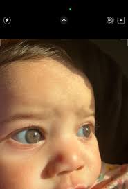 Possible 7-month-old baby change in eye color?