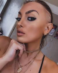 Ex On The Beach star ZaraLena Jackson undergoing alopecia treatment after  losing hair