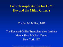 Milan criteria are the most frequently used limits for liver transplantation (lt) in patients with hepatocellular carcinoma (hcc), but our previous experience with expanded criteria showed. Ppt Liver Transplantation For Hcc Beyond The Milan Criteria Powerpoint Presentation Id 439159
