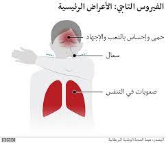 أعراض فيروس كورونا المتحور السعال المستمر آلام في الصدر ، حمى فقدان حاسة التذوق والشم صداع الراس التعب ألم عضلي إسهال الالتباس ÙÙŠØ±ÙˆØ³ ÙƒÙˆØ±ÙˆÙ†Ø§ ÙƒÙ„ Ù…Ø§ ØªØ±ÙŠØ¯ Ù…Ø¹Ø±ÙØªÙ‡ Ø¹Ù†Ù‡ ÙˆØ£Ø¹Ø±Ø§Ø¶Ù‡ ÙˆØ§Ù„ÙˆÙ‚Ø§ÙŠØ© Ù…Ù†Ù‡ Bbc News Ø¹Ø±Ø¨ÙŠ