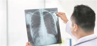 Wie Gut Ist Eine Leichte Copd Im Rontgen Thorax Erkennbar