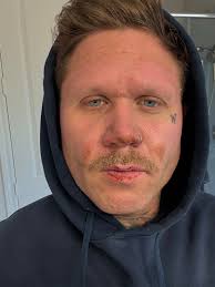 Take this as a reminder to always wear your PPE. Mackenzie here recently  took some heat from a phase to phase 34.5kv flash in, good thing he was  wearing his Performance Vise.