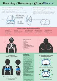 How Qualibreath Helps Breathing After Open Heart Surgery Heart Surgery Heart Surgery Recovery Open Heart Surgery