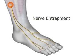 Did you know the average person if you are experiencing pain on top of your foot, you should consider seeing your doctor as soon as possible. Pain On Top Of Foot Causes Symptoms Treatment