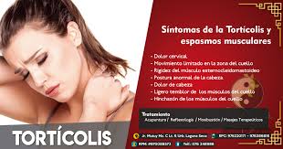 🧘‍♂ Si tienes estos síntomas ten cuidado puedes sufrir de Tortícolis y  espasmos musculares 🔘 Dolor cervical 🔘 Movimiento limitado en la zona del  cuello 🔘 Rigidez del músculo esternocleidomastoideo 🔘 Postura