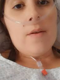 O coronavírus entra, principalmente, pela muscosa nasal do paciente, até chegare ao pulmão. Aos 36 Mulher Foi Internada Por Covid 19 Com 90 Do Pulmao Comprometido 17 03 2021 Uol Vivabem