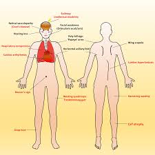 This type of muscle creates movement in the body. Ijms Free Full Text Early Onset Infantile Facioscapulohumeral Muscular Dystrophy A Timely Review Html