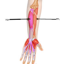 The fds tendon divides into two slips that wrap around the fdp to insert into the sides of the middle phalanx. Anatomy Shoulder And Upper Limb Hand Flexor Digitorum Profundus Muscle Article