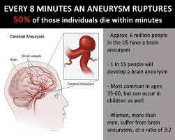 September Is Brain Aneurysm Awareness Month Brain Aneurysm